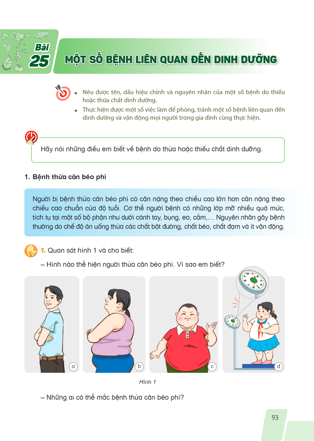 Bài 25. Một số bệnh liên quan đến dinh dưỡng Nêu được tên, dấu hiệu chính và nguyên nhân của một số bệnh do thiếu hoặc thừa chất dinh dưỡng. Thực hiện được một 