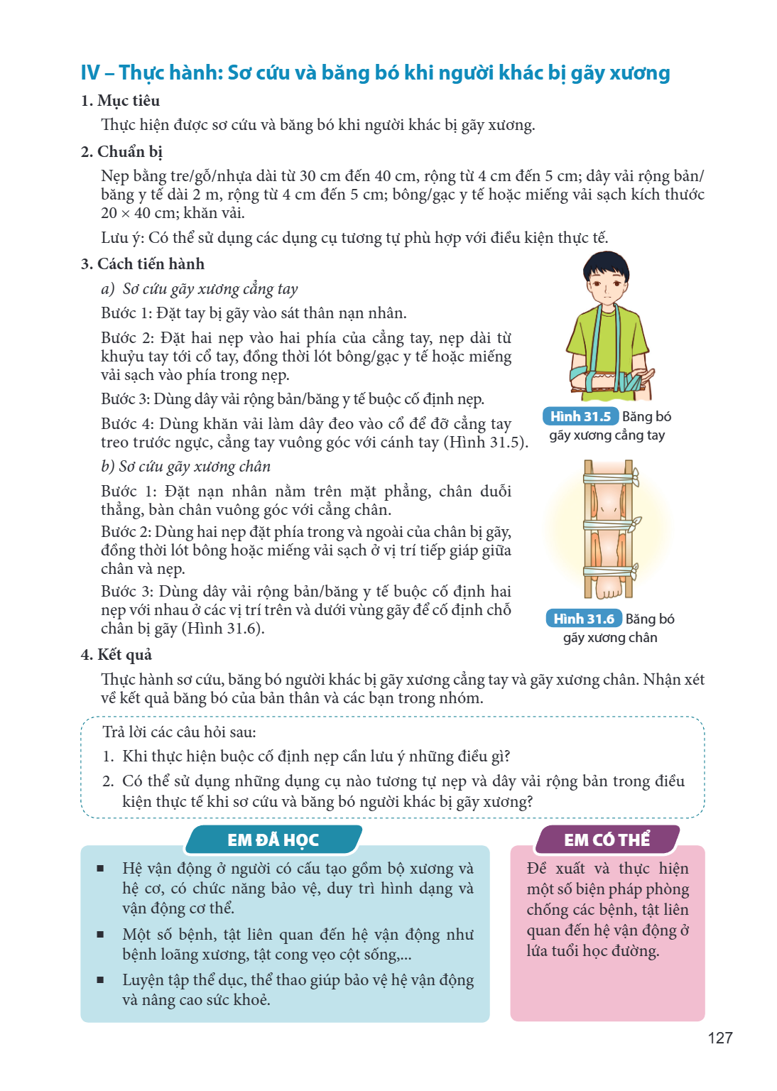 IV – Thực hành: Sơ cứu và băng bó khi người khác bị gãy xương 1. Mục tiêu Thực hiện được sơ cứu và băng bó khi người khác bị gãy xương. 2. Chuẩn bị Nẹp bằng tre