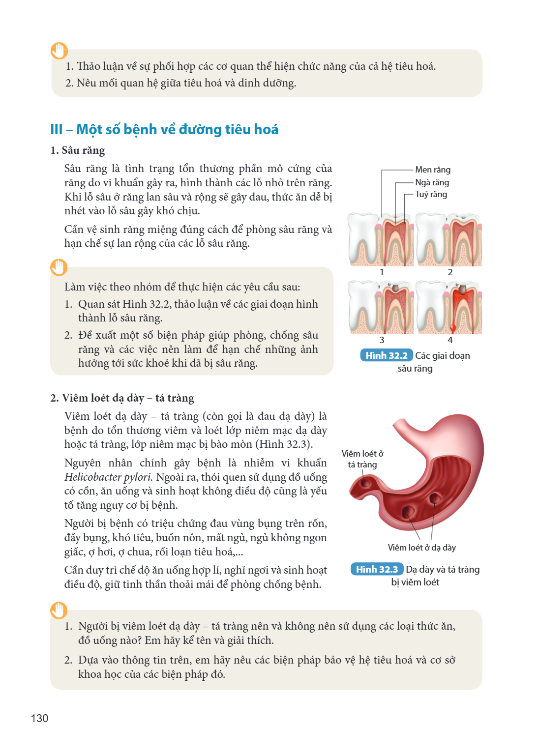 Thảo luận về sự phối hợp các cơ quan thể hiện chức năng của cả hệ tiêu hoá. Nêu mối quan hệ giữa tiêu hoá và dinh dưỡng. III – Một số bệnh về đường tiêu hoá 1. 