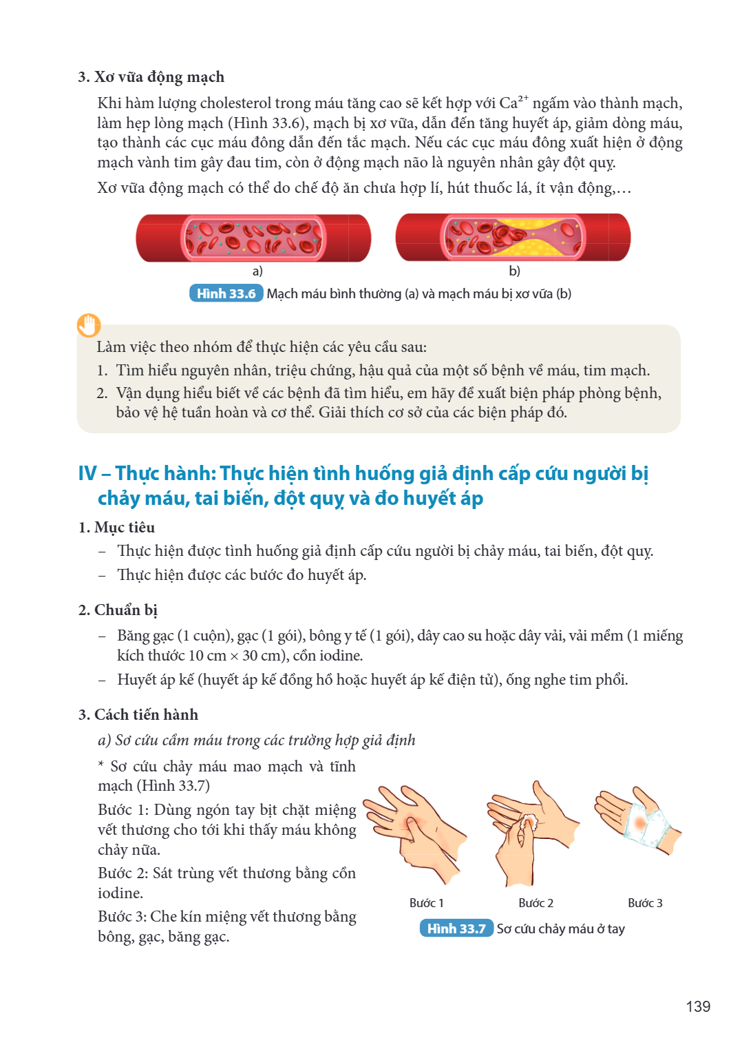 3. Xơ vữa động mạch Khi hàm lượng cholesterol trong máu tăng cao sẽ kết hợp với $\mathrm{Ca}^{2+}$ ngấm vào thành mạch, làm hẹp lòng mạch (Hình 33.6), mạch bị x