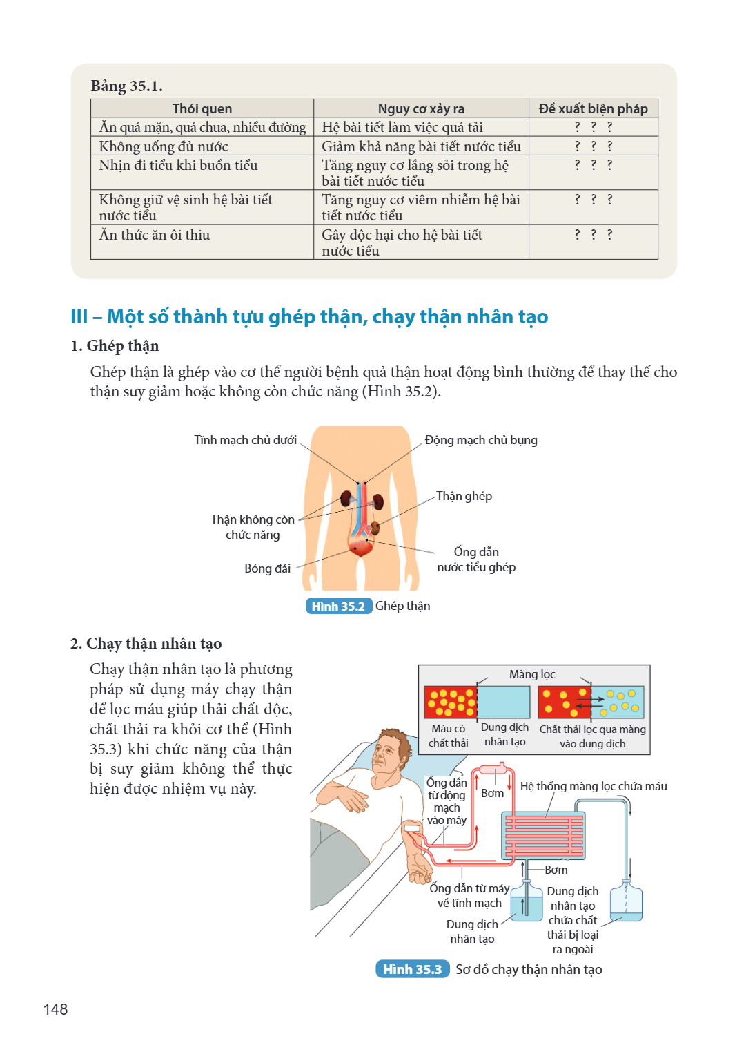 Bảng 35.1. Thói quen, Nguy cơ xảy ra, Đề xuất biện pháp Ăn quá mặn, quá chua, nhiều đường, Hệ bài tiết làm việc quá tải, ? ? ? Không uống đủ nước, Giảm khả năng