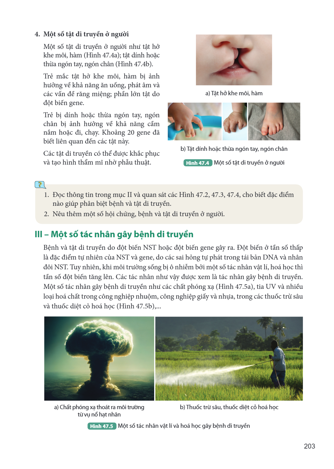 4. Một số tật di truyền ở người Một số tật di truyền ở người như tật hở khe môi, hàm (Hình 47.4a); tật dính hoặc thừa ngón tay, ngón chân (Hình 47.4b). Trẻ mắc 