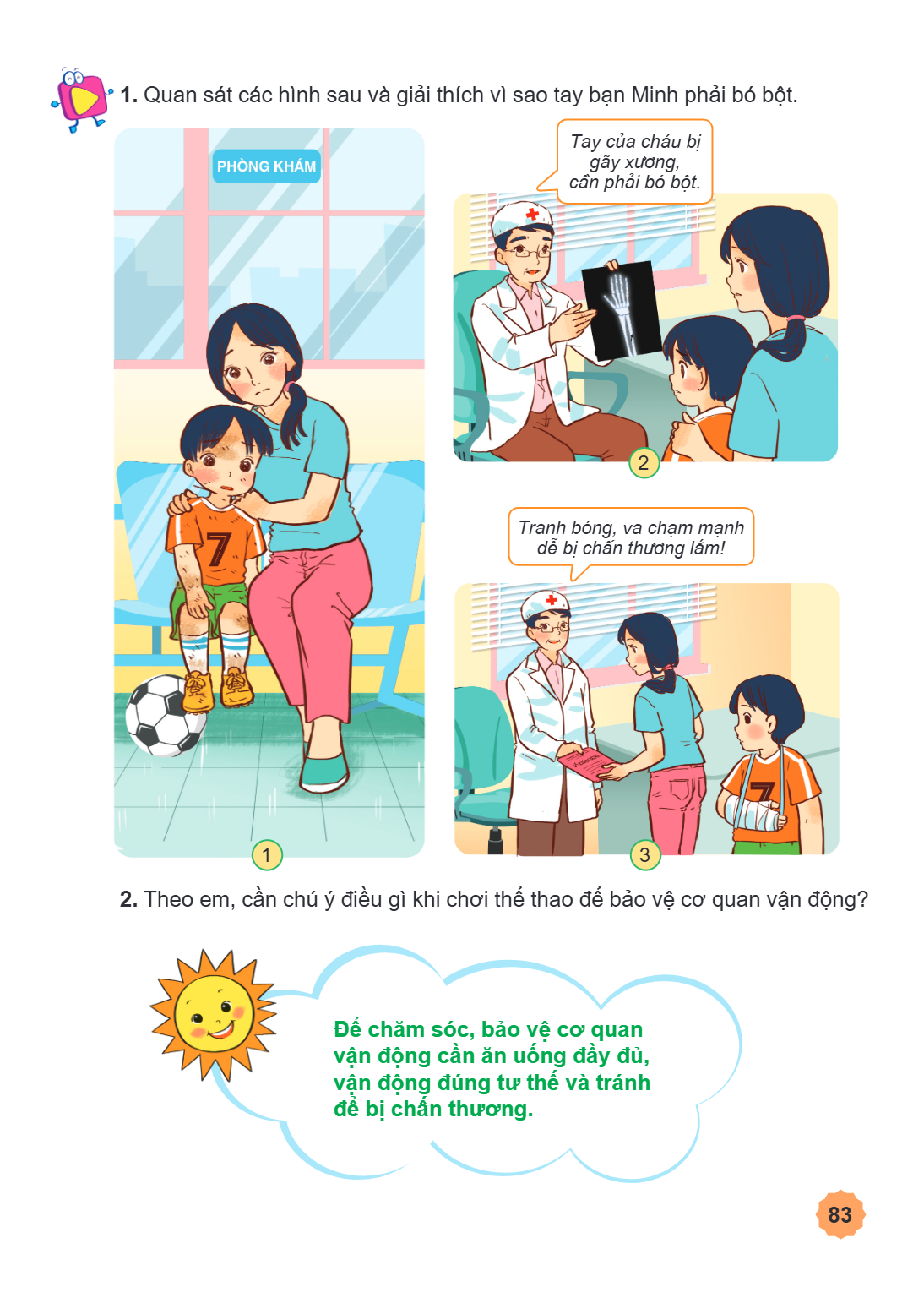 1. Quan sát các hình sau và giải thích vì sao tay bạn Minh phải bó bột. Tay của cháu bị gãy xương, cần phải bó bột. 2 Tranh bóng, va chạm mạnh dễ bị chấn thương